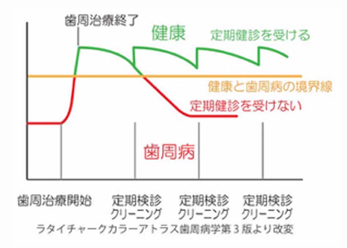 定期健診の重要性