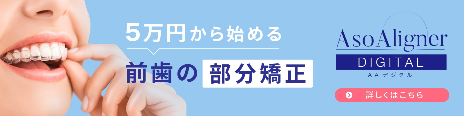 5万円から始める前歯の部分矯正